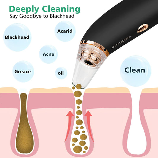 **Rechargeable Blackhead Remover Vacuum – Powerful Pore Cleaner**