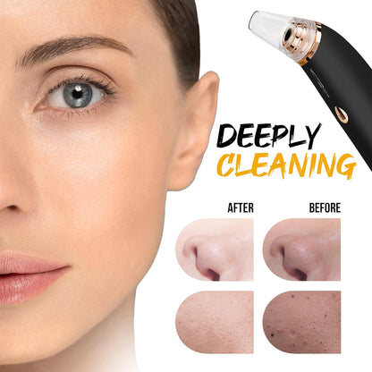 **Rechargeable Blackhead Remover Vacuum – Powerful Pore Cleaner**